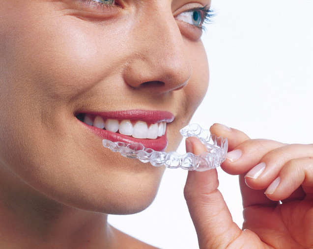 Centro Invisalign Provider - Studio Odontoiatrico Dr Giorgio Palmigiani Isola del Liri